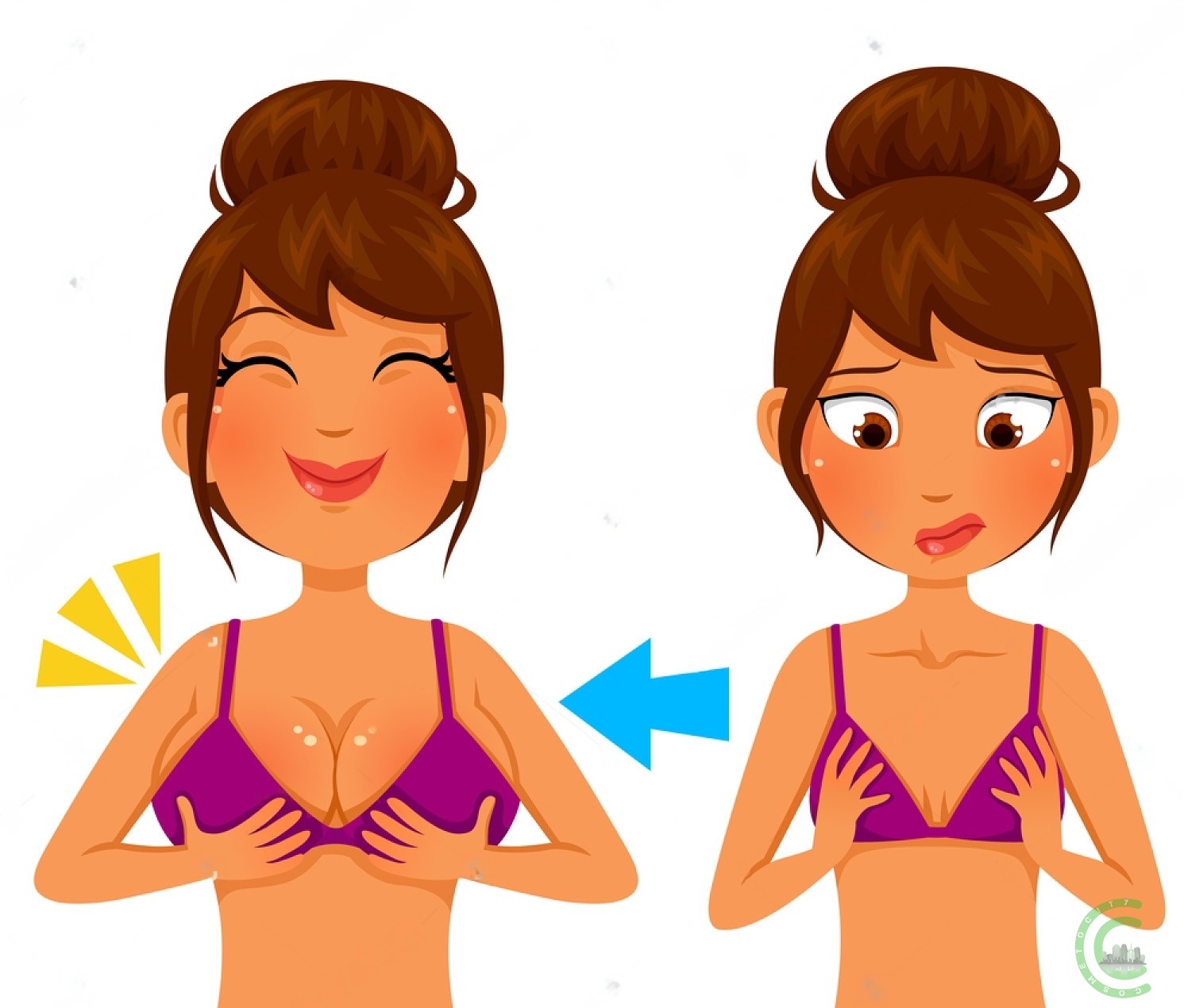 Breast Lift Surgery: An Overview
