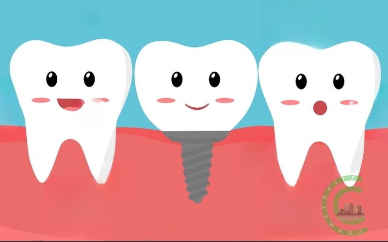 How long does a gum take to heal with an implant?