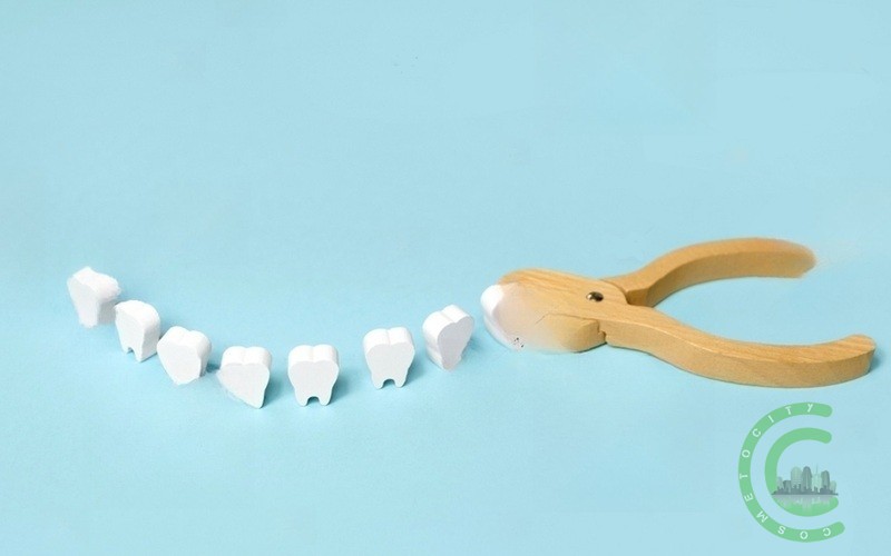 How many teeth do you need for implants?