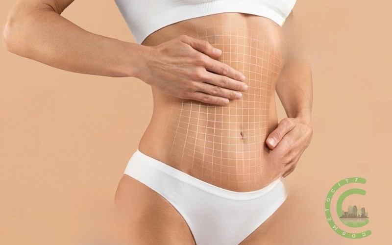 Do breasts sag after tummy tuck?