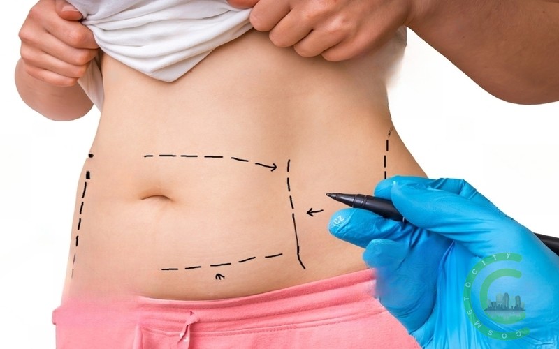 Do breasts look bigger after tummy tuck?