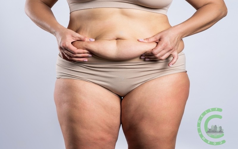 Can your stomach get fat again after a tummy tuck?