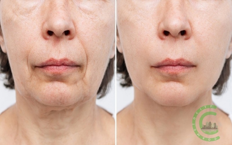 What surgeries make your face look better?