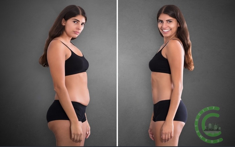 How much weight can you lose with liposuction?