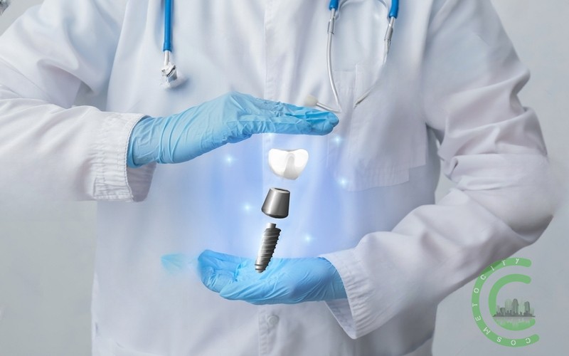 All-on-4 Dental Implants: Die Vor- und Nachteile