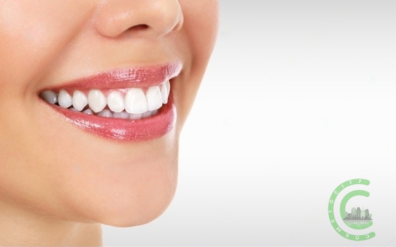 Kann ich alle meine Zähne implantieren?