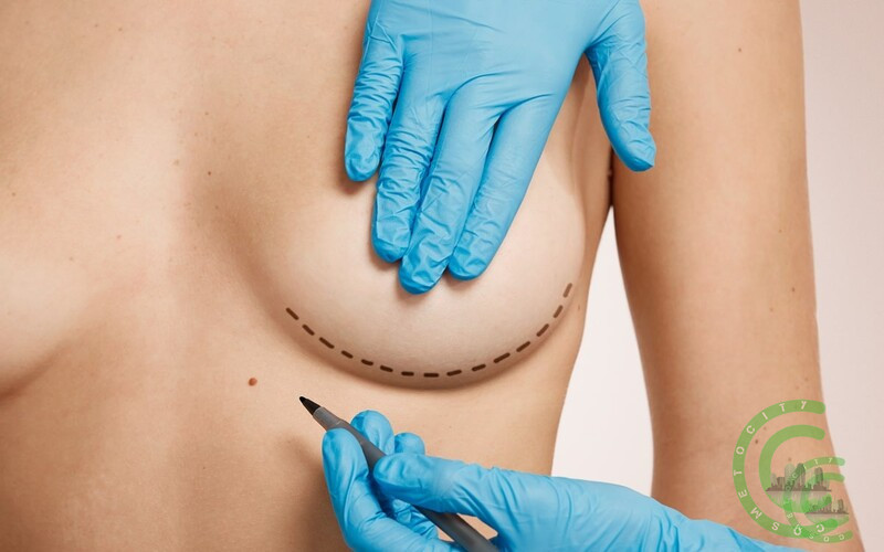 Breast Augmentation Surgery: An Overview