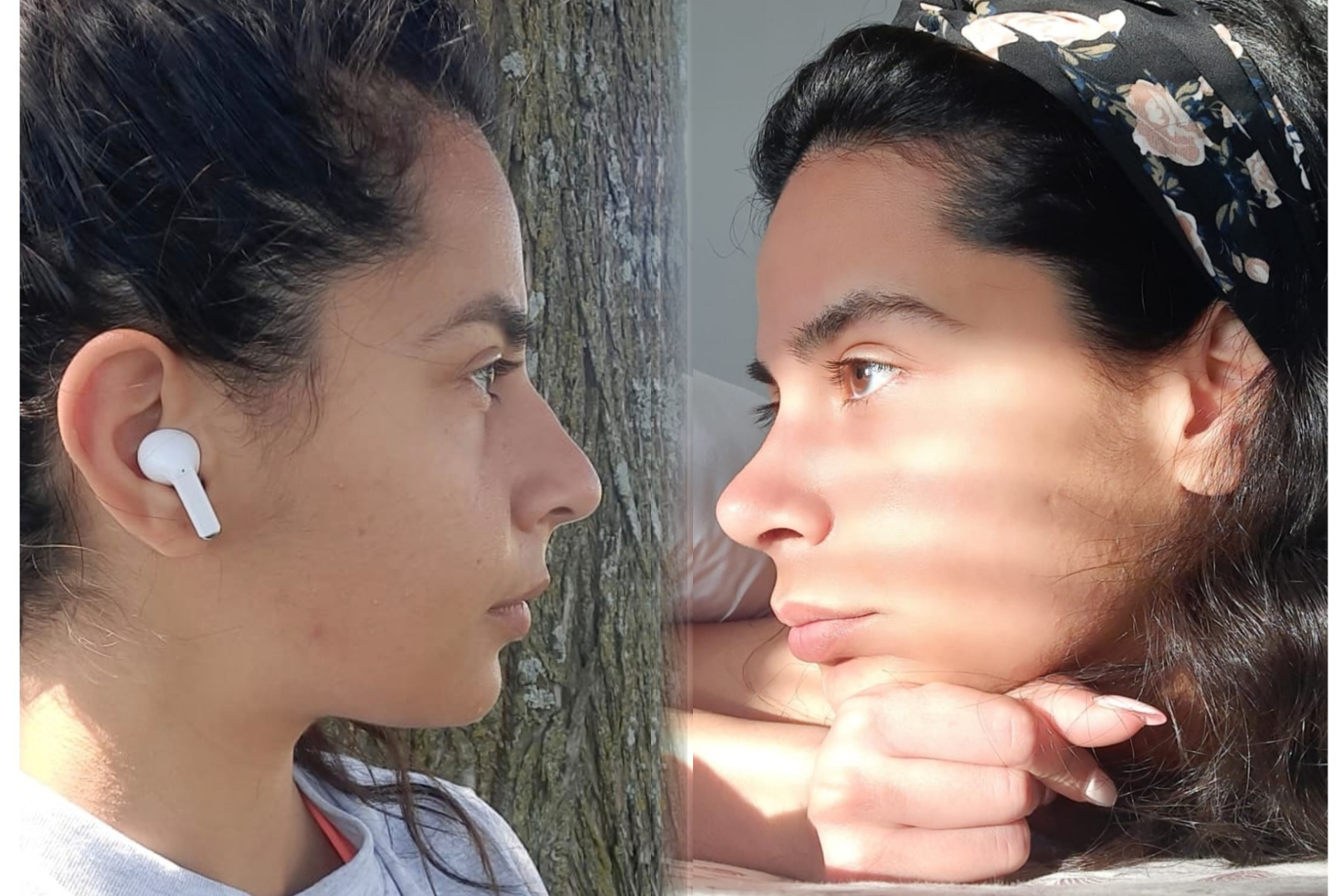 Sarah Rhinoplasty