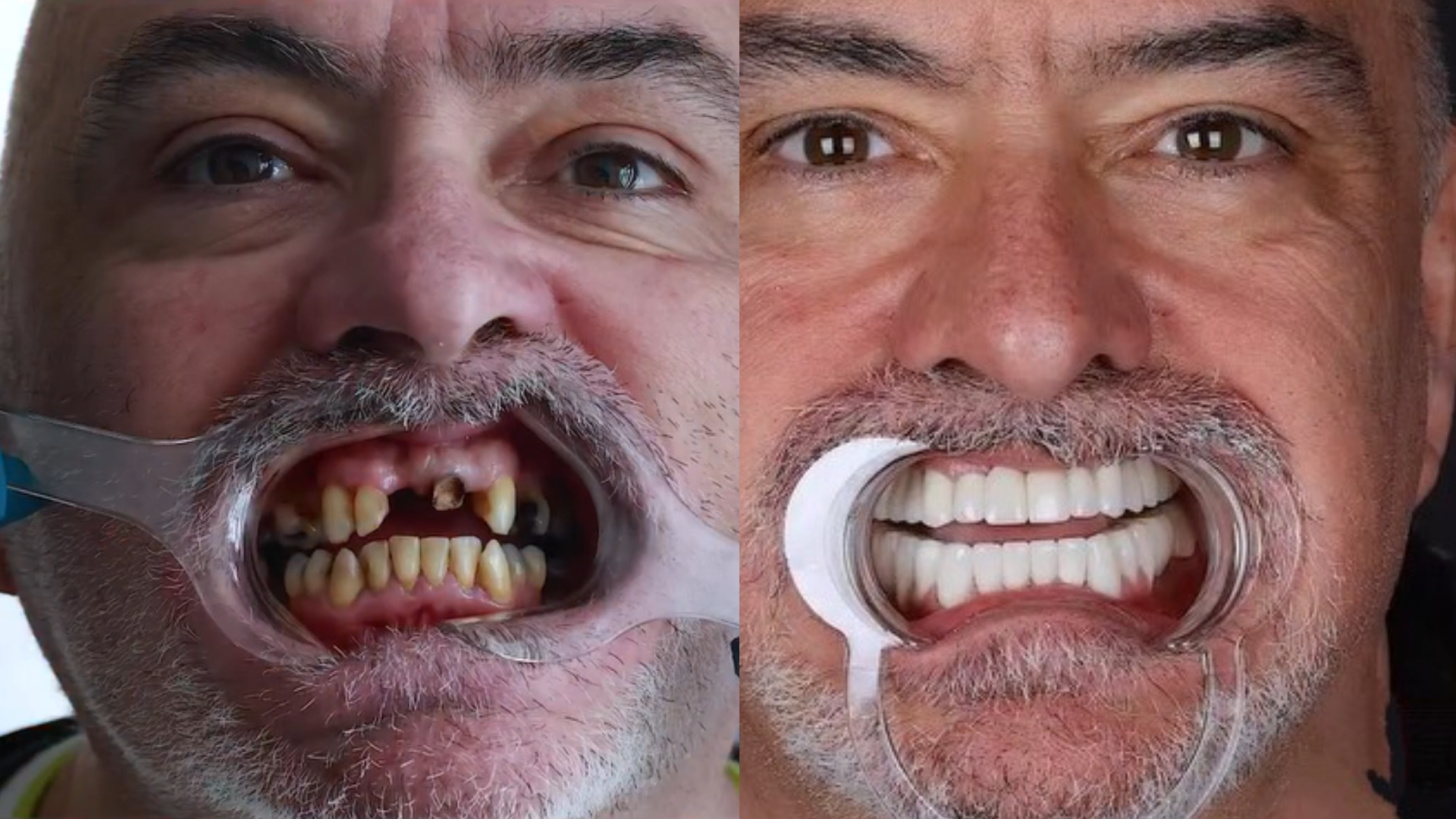 dental treatment
